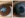 Чем отличаются катаракта и глаукома? — Читать подробнее на нашем сайте. Офтал...